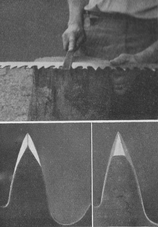 Foto Arbeitsstellung zum Brechen der Schneidezahnkanten